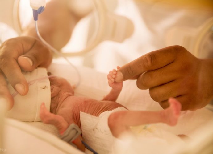 koraszülött intenzív osztály PIC