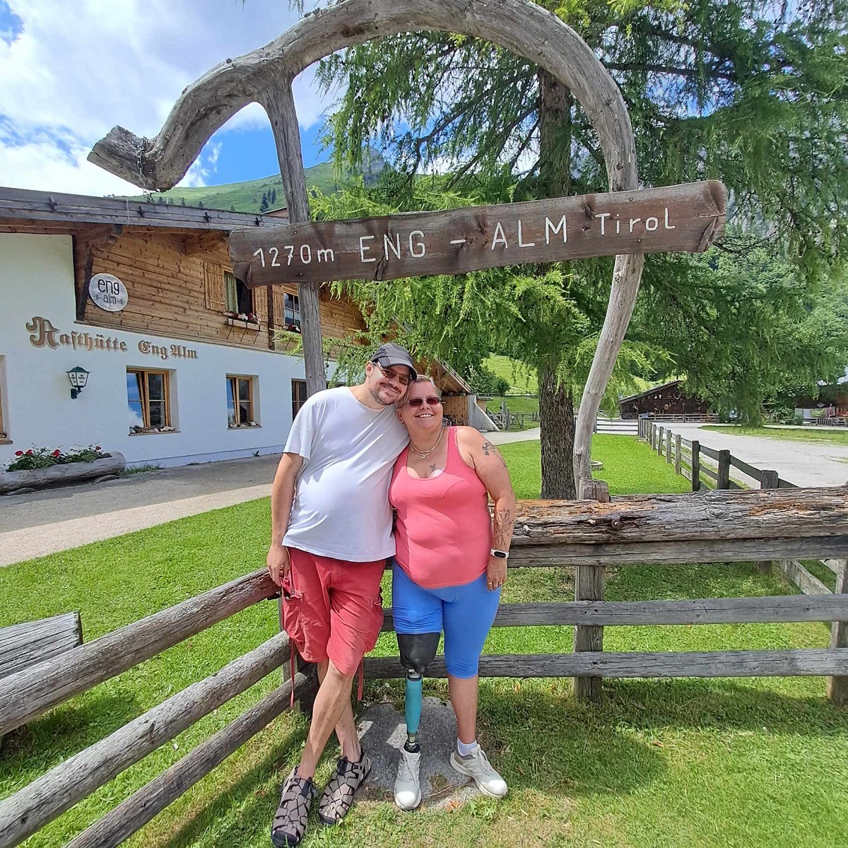 Fél lábbal, lábprotézis, protézis