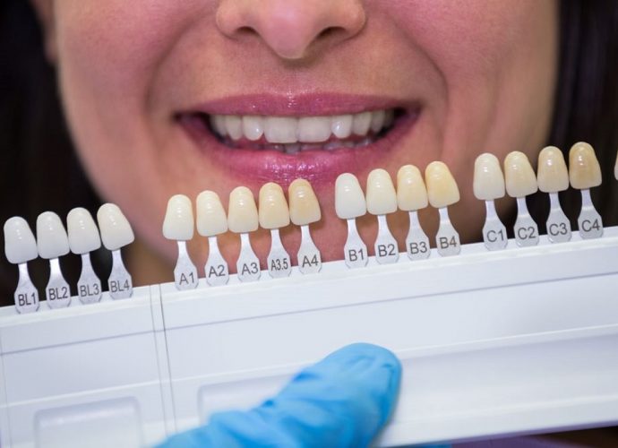 milyen fogkoronát válasszak, a Dentpoint Implantológiai és Parodontológiai Centrum