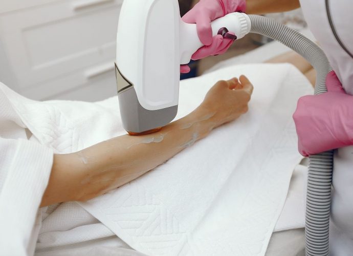 lézeres szőrtelenítés