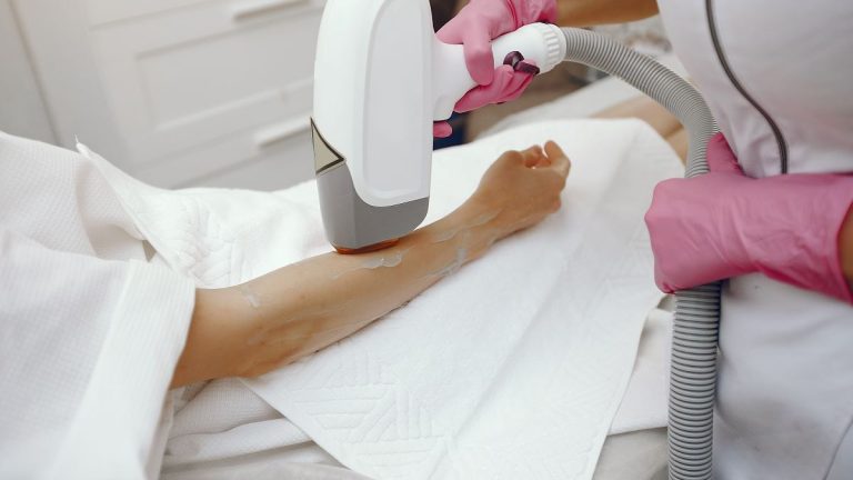 lézeres szőrtelenítés